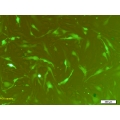 GFP Expressing Mouse Liver, Bone Marrow Cells ...